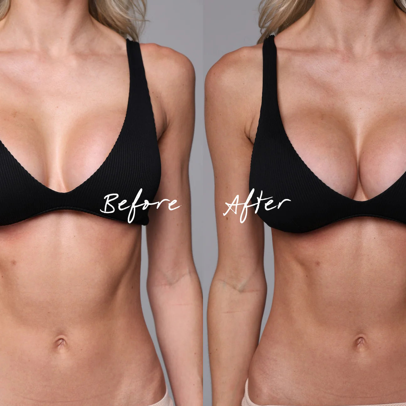 קאפים דביקים - להגדלת חזה